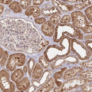 Anti-AACS antibody produced in rabbit 