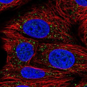 Anti-AACS antibody produced in rabbit 
