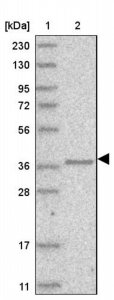 Anti-AASDHPPT antibody produced in rabbit 