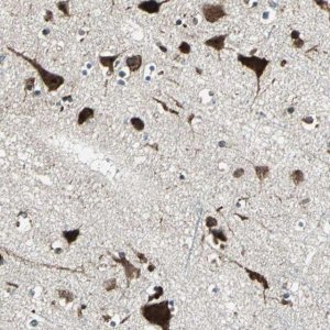 Anti-AATF antibody produced in rabbit 