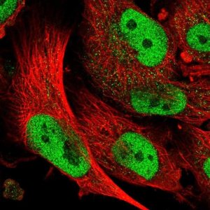 Anti-ABCA1 antibody produced in rabbit 