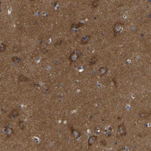 Anti-ABCA10 antibody produced in rabbit 