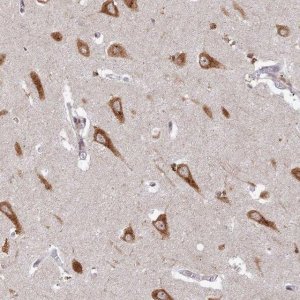 Anti-ABCA2 antibody produced in rabbit 