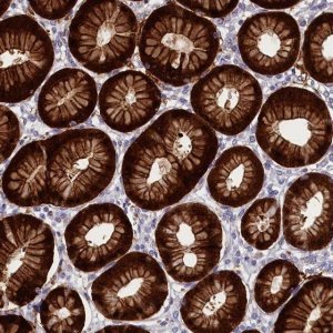 Anti-ABCC12 antibody produced in rabbit 