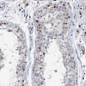 Anti-ABCG4 antibody produced in rabbit 