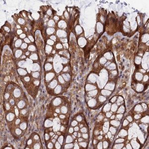 Anti-ABHD1 antibody produced in rabbit 