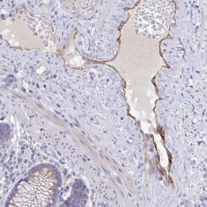 Anti-ABHD16A antibody produced in rabbit 