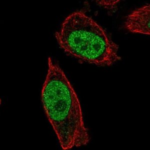 Anti-ABHD16B antibody produced in rabbit 