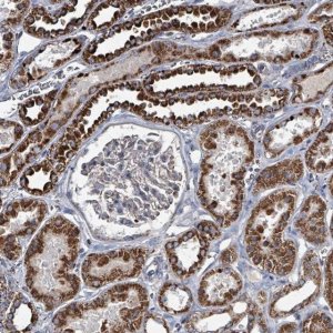 Anti-ABHD18 antibody produced in rabbit 