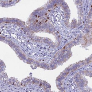 Anti-ABI3BP antibody produced in rabbit 