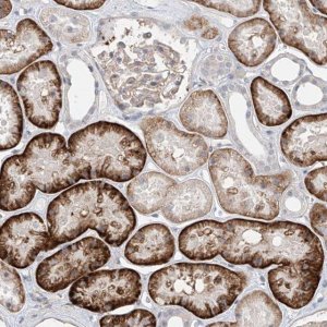 Anti-ABLIM2 antibody produced in rabbit 