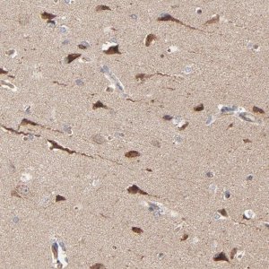 Anti-ABLIM3 antibody produced in rabbit 