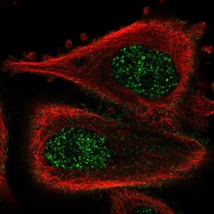 Anti-ABLIM3 antibody produced in rabbit 