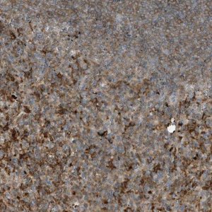 Anti-ABTB1 antibody produced in rabbit 