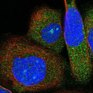 Anti-ABTB1 antibody produced in rabbit 