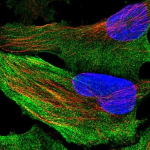 Anti-ACACA antibody produced in rabbit 