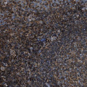 Anti-ACCS antibody produced in rabbit 