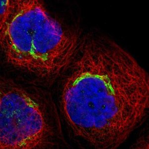 Anti-ACCS antibody produced in rabbit 