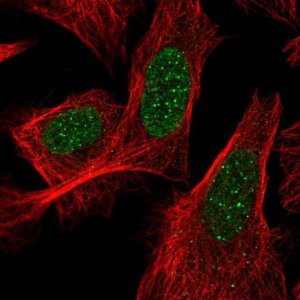 Anti-ACD antibody produced in rabbit 
