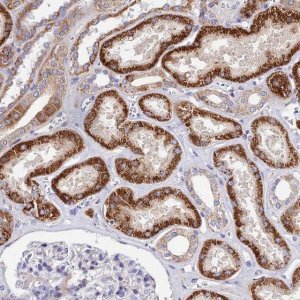 Anti-ACOT1 antibody produced in rabbit 