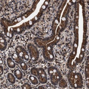 Anti-ACOX1 antibody produced in rabbit 