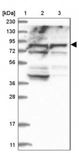 Anti-ACOX3 antibody produced in rabbit 