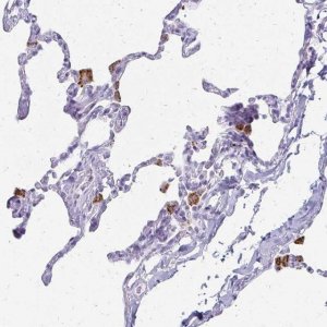 Anti-ACP5 antibody produced in rabbit 
