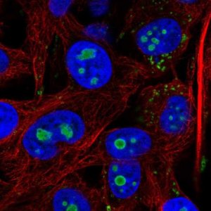 Anti-ACSL3 antibody produced in rabbit 