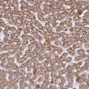 Anti-ACSM2A antibody produced in rabbit 