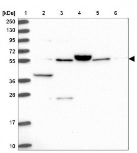 Anti-ACSM6 antibody produced in rabbit 