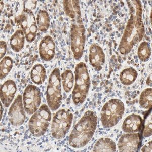 Anti-ACSS2 antibody produced in rabbit HPA004141-100UL