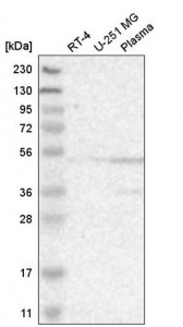 Anti-ACTL6A antibody produced in rabbit HPA018671-100UL