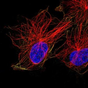 Anti-ACTR1A antibody produced in rabbit 