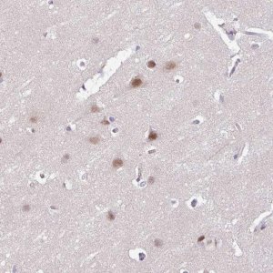 Anti-ACTR3 antibody produced in rabbit 