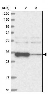 Anti-ACTR6 antibody produced in rabbit 