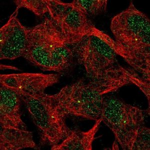 Anti-ACTR8 antibody produced in rabbit 