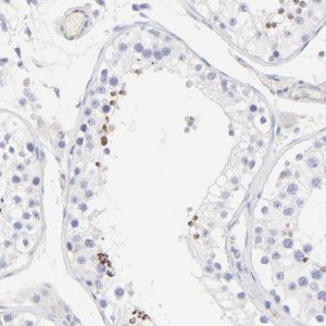 Anti-ACTRT1 antibody produced in rabbit 