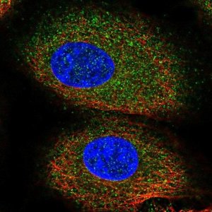 Anti-ACVR1B antibody produced in rabbit HPA063761-100UL