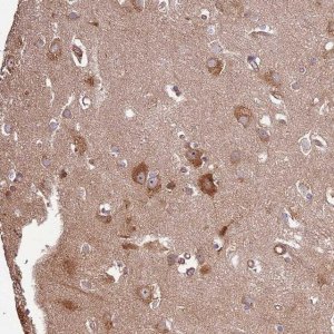 Anti-ACVR2A antibody produced in rabbit 