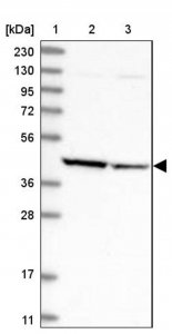 Anti-ACY1 antibody produced in rabbit 