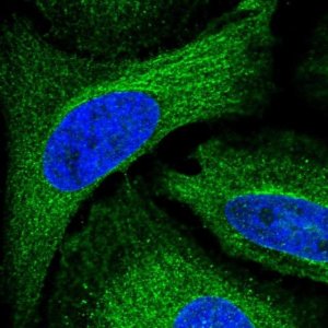 Anti-ADAL antibody produced in rabbit 