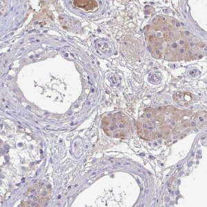 Anti-ADAM21 antibody produced in rabbit 