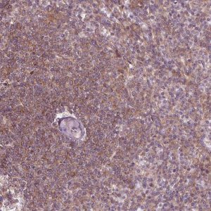 Anti-ADAM33 antibody produced in rabbit 