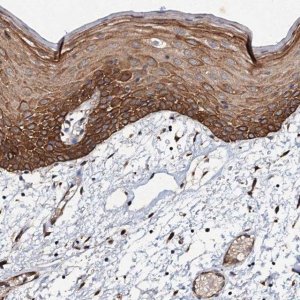 Anti-ADAMTS10 antibody produced in rabbit 