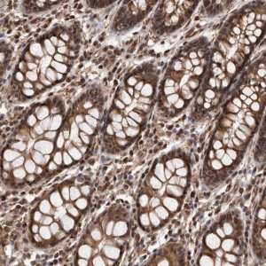 Anti-ADAMTS20 antibody produced in rabbit 