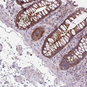 Anti-ADAMTSL2 antibody produced in rabbit 