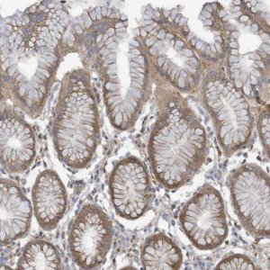 Anti-ADAT2 antibody produced in rabbit 