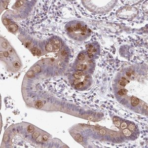 Anti-ADAT3 antibody produced in rabbit 