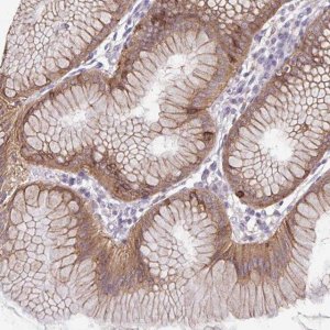 Anti-ADAT3 antibody produced in rabbit 