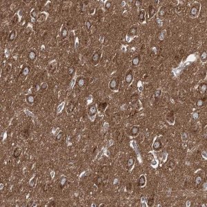 Anti-ADCY2 antibody produced in rabbit 